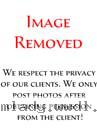 img-removed-lg
